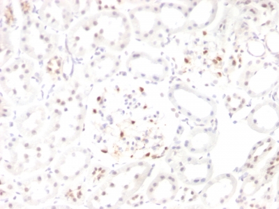 Formalin-fixed, paraffin embedded rat kidney sections stained with 100 ul anti-Wilms Tumor 1 (clone WT1/857 + 6F-H2) at 1:200. HIER epitope retrieval prior to staining was performed in 10mM Citrate, pH 6.0.